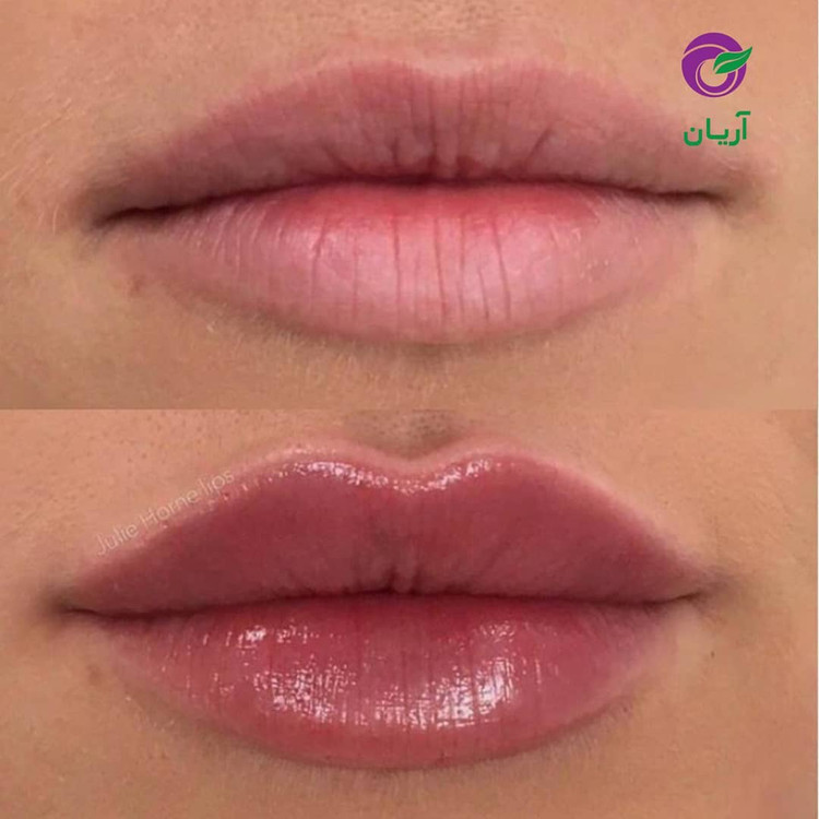 رژلب مایع حجم دهنده صورتی/شماره 124 /برند لاکچری کوین