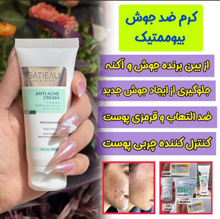 پک دو محصوله رفع لک و اکنه و جوش و رفع منافذ ژل انتی اکنه گاتیو --- ژل شست و شو ویتابلا